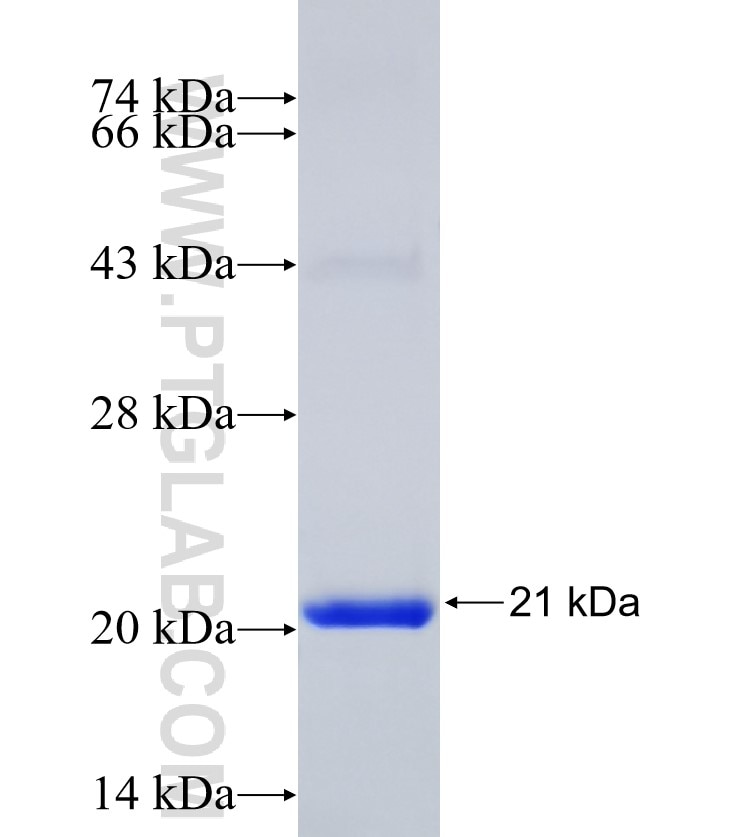 ADPGK fusion protein Ag31242 SDS-PAGE