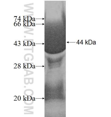 ADPGK fusion protein Ag8154 SDS-PAGE