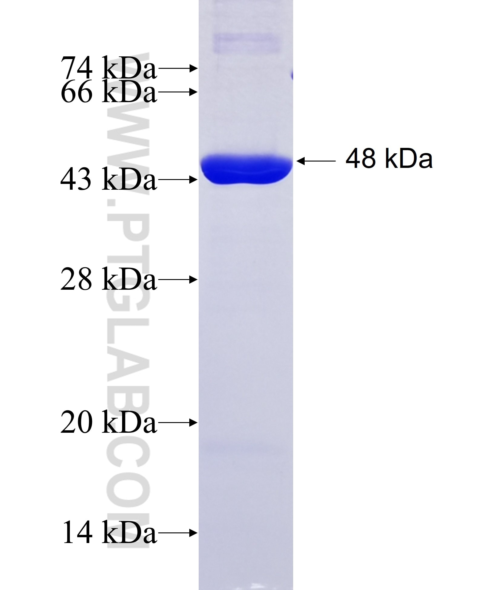 ADPGK fusion protein Ag8154 SDS-PAGE