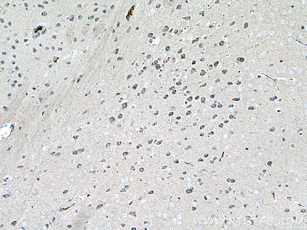 Immunohistochemistry (IHC) staining of mouse brain tissue using ADPRH Polyclonal antibody (17911-1-AP)