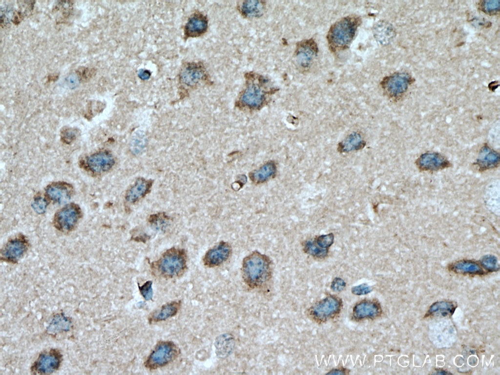 Immunohistochemistry (IHC) staining of mouse brain tissue using ADPRH Polyclonal antibody (17911-1-AP)