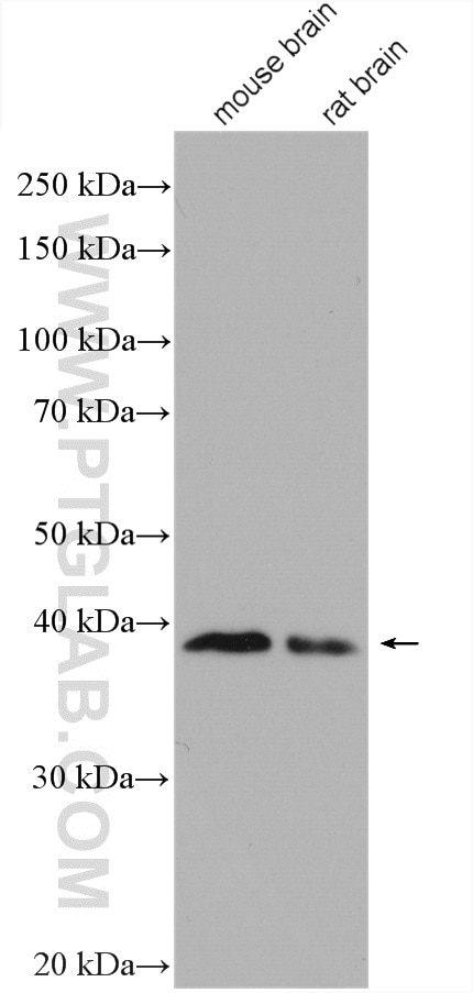 Western Blot (WB) analysis of various lysates using ADPRH Polyclonal antibody (17911-1-AP)