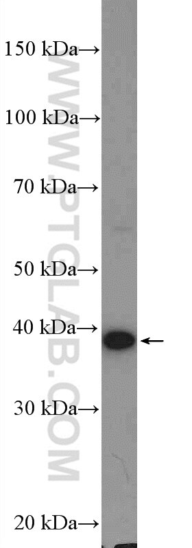 Western Blot (WB) analysis of mouse brain tissue using ADPRH Polyclonal antibody (17911-1-AP)