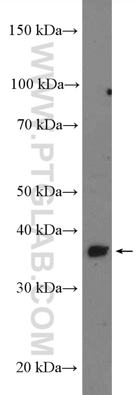 Western Blot (WB) analysis of mouse brain tissue using ADPRH Polyclonal antibody (17911-1-AP)