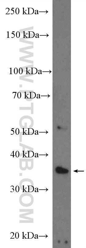 Western Blot (WB) analysis of rat brain tissue using ADPRH Polyclonal antibody (17911-1-AP)