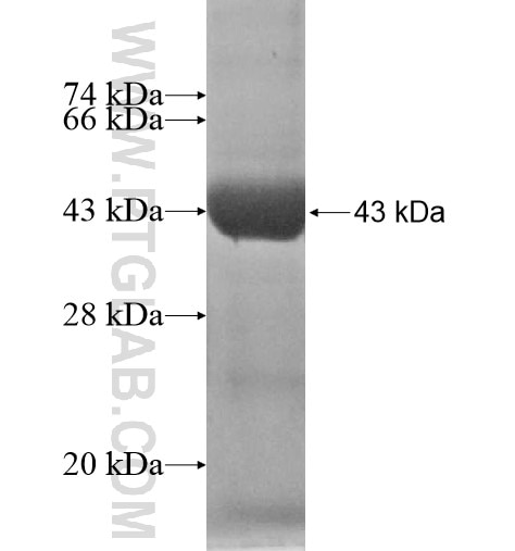 ADPRH fusion protein Ag12226 SDS-PAGE