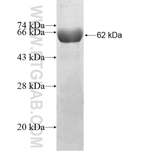 ADPRH fusion protein Ag12311 SDS-PAGE