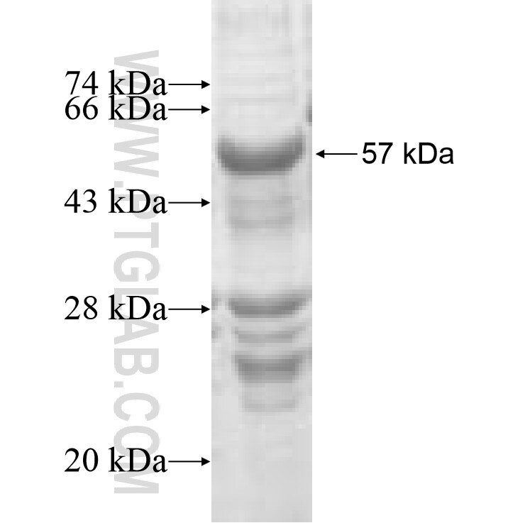 ADPRHL1 fusion protein Ag8858 SDS-PAGE