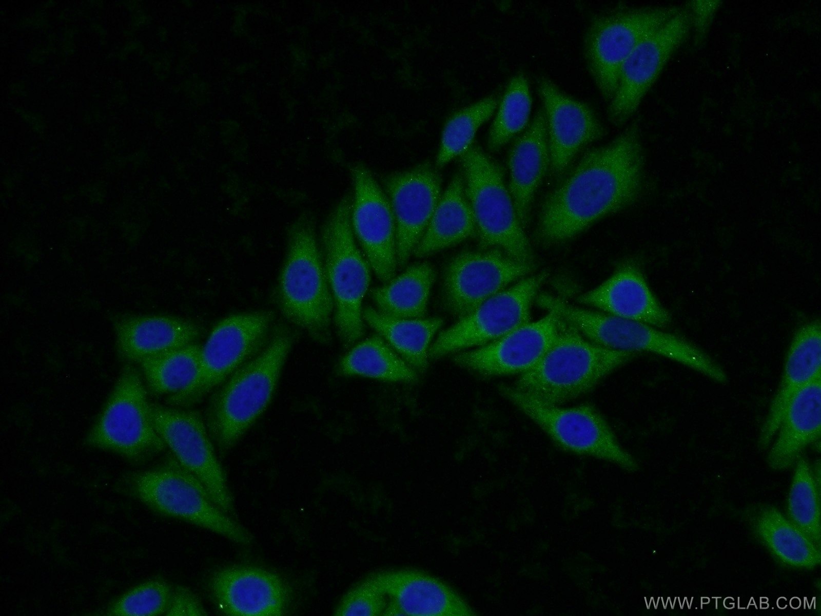 Immunofluorescence (IF) / fluorescent staining of HepG2 cells using ARH3 Polyclonal antibody (16504-1-AP)