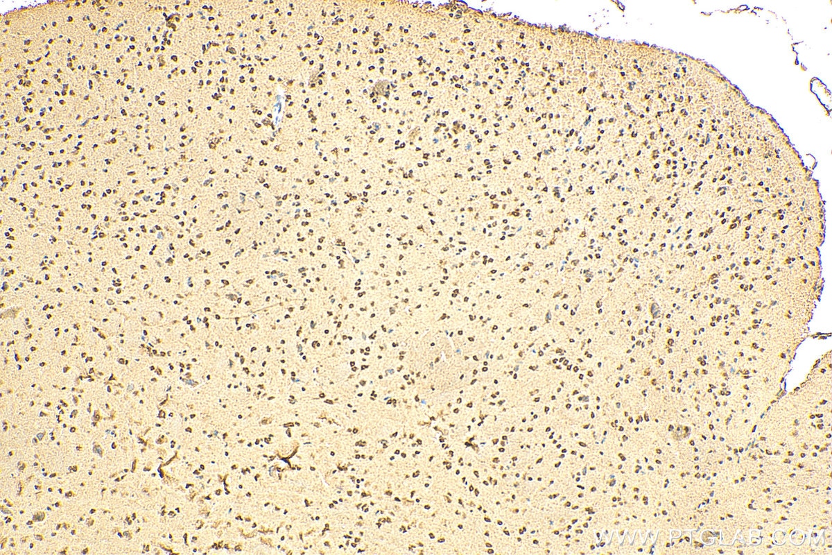 Immunohistochemistry (IHC) staining of mouse brain tissue using ARH3 Polyclonal antibody (16504-1-AP)