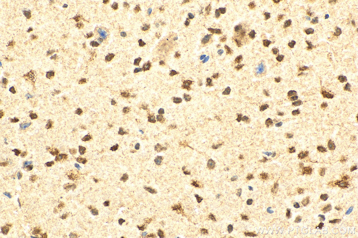 IHC staining of mouse brain using 16504-1-AP