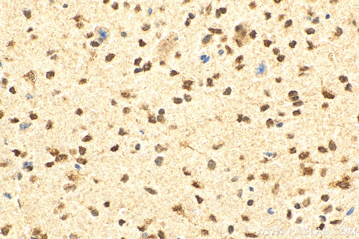 Immunohistochemistry (IHC) staining of mouse brain tissue using ARH3 Polyclonal antibody (16504-1-AP)