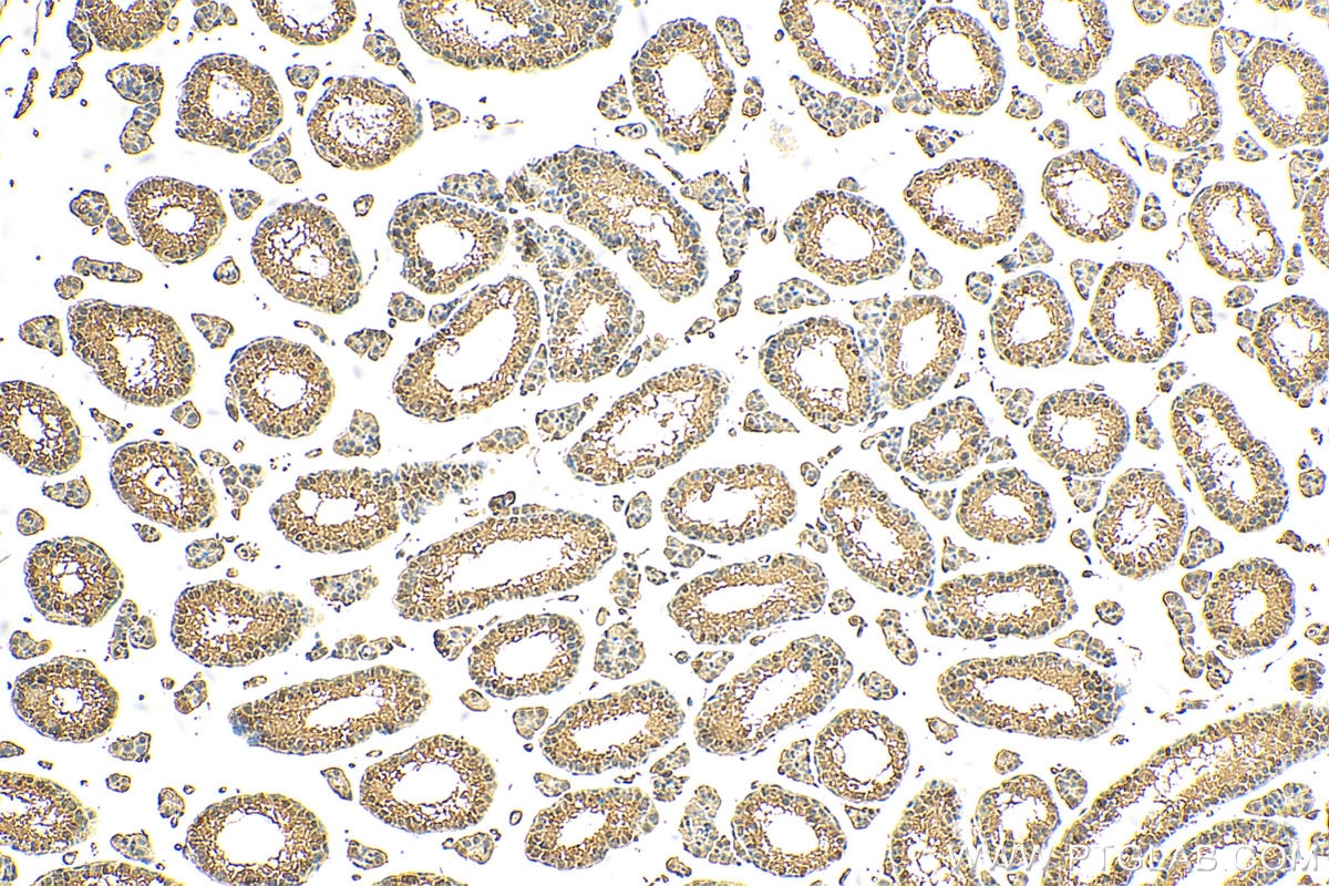 IHC staining of mouse testis using 16504-1-AP