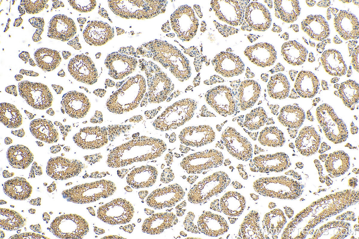 Immunohistochemistry (IHC) staining of mouse testis tissue using ARH3 Polyclonal antibody (16504-1-AP)