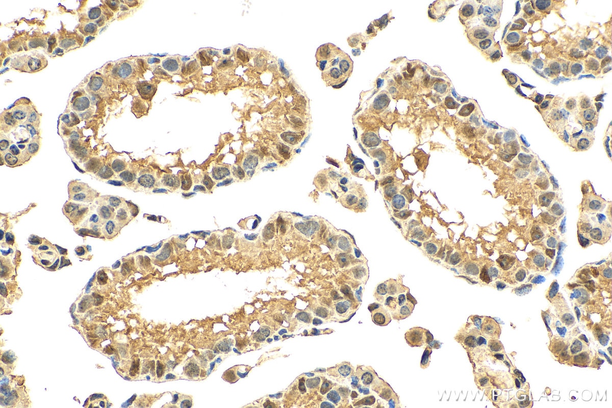 Immunohistochemistry (IHC) staining of mouse testis tissue using ARH3 Polyclonal antibody (16504-1-AP)