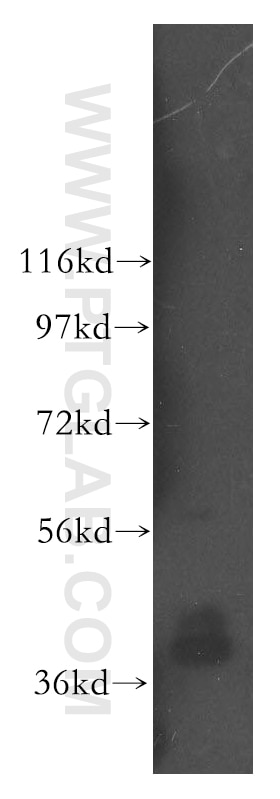 WB analysis of HeLa using 16504-1-AP