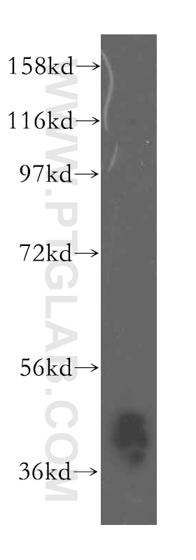 Western Blot (WB) analysis of mouse heart tissue using ARH3 Polyclonal antibody (16504-1-AP)