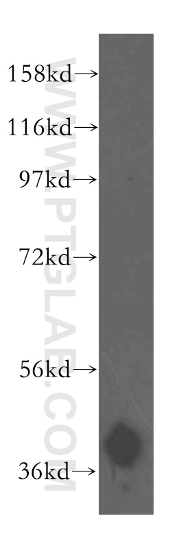 WB analysis of mouse kidney using 16504-1-AP