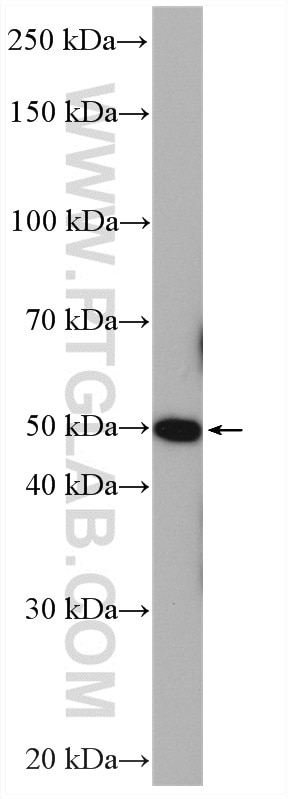 Western Blot (WB) analysis of mouse brain tissue using ADRA1A-Specific Polyclonal antibody (19777-1-AP)