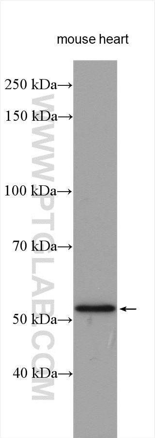 Western Blot (WB) analysis of various lysates using ADRA1A-Specific Polyclonal antibody (19777-1-AP)