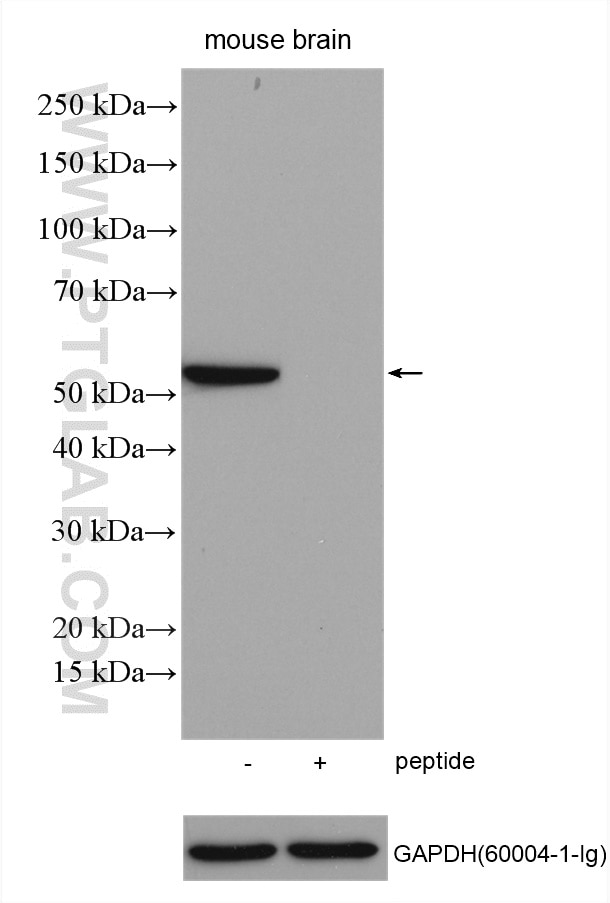 Western Blot (WB) analysis of various lysates using ADRA1A-Specific Polyclonal antibody (19777-1-AP)