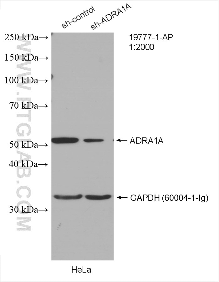 Western Blot (WB) analysis of HeLa cells using ADRA1A-Specific Polyclonal antibody (19777-1-AP)
