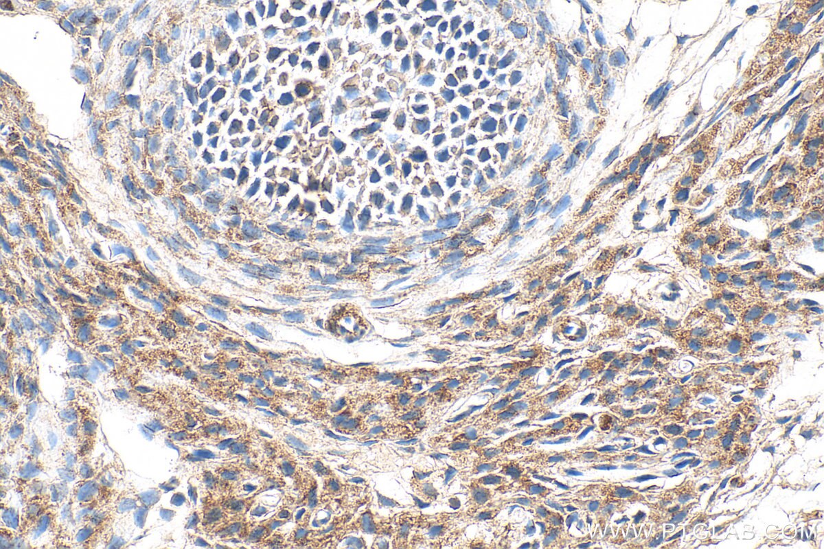 Immunohistochemistry (IHC) staining of rat ovary tissue using ADRA1B Polyclonal antibody (22419-1-AP)