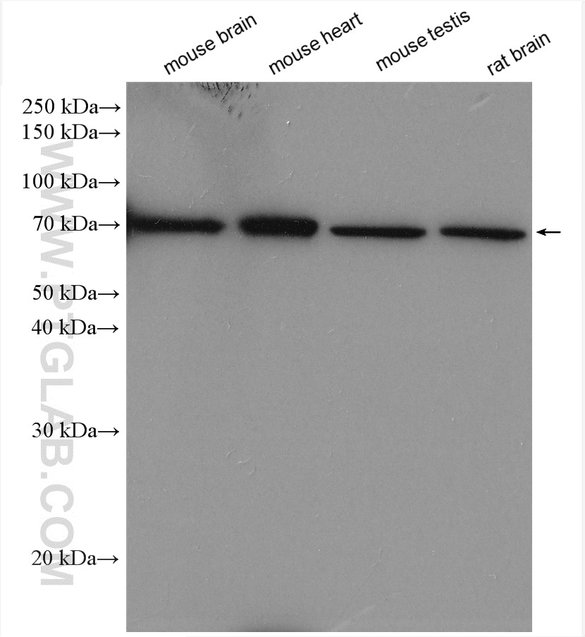 Western Blot (WB) analysis of various lysates using ADRA1B Polyclonal antibody (22419-1-AP)