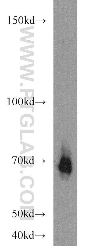 ADRA1B Polyclonal antibody