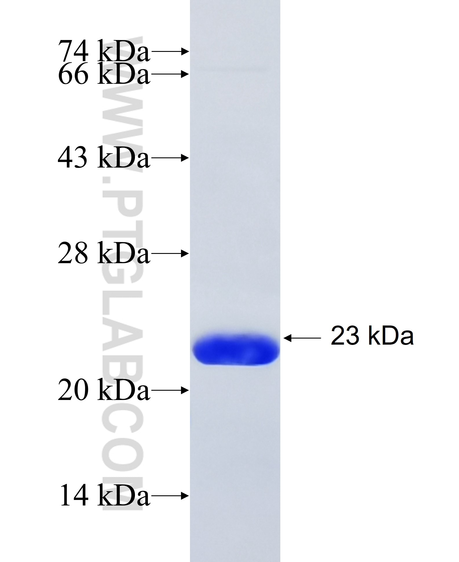 ADRA1B fusion protein Ag35039 SDS-PAGE