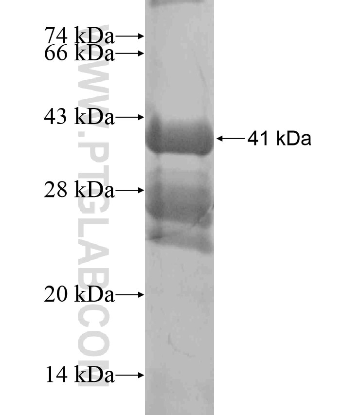 ADRA1B fusion protein Ag18138 SDS-PAGE
