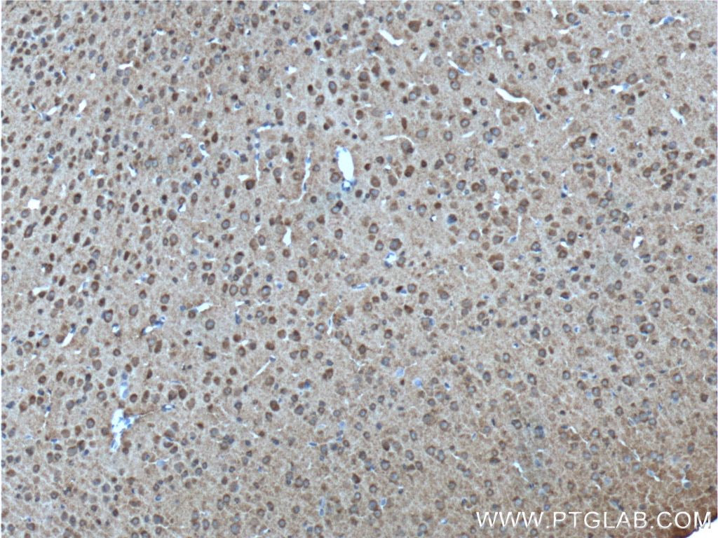 Immunohistochemistry (IHC) staining of mouse brain tissue using ADRA1B-Specific Polyclonal antibody (19776-1-AP)