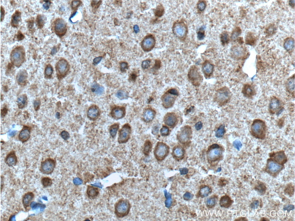 Immunohistochemistry (IHC) staining of mouse brain tissue using ADRA1B-Specific Polyclonal antibody (19776-1-AP)