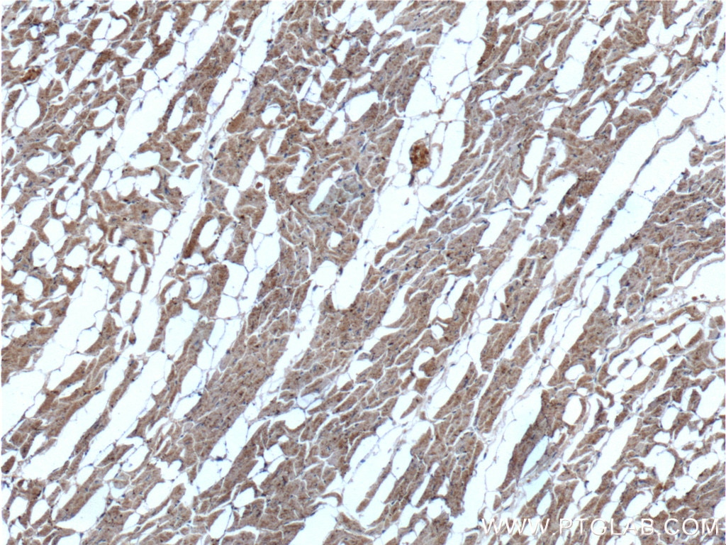 Immunohistochemistry (IHC) staining of human heart tissue using ADRA1B-Specific Polyclonal antibody (19776-1-AP)