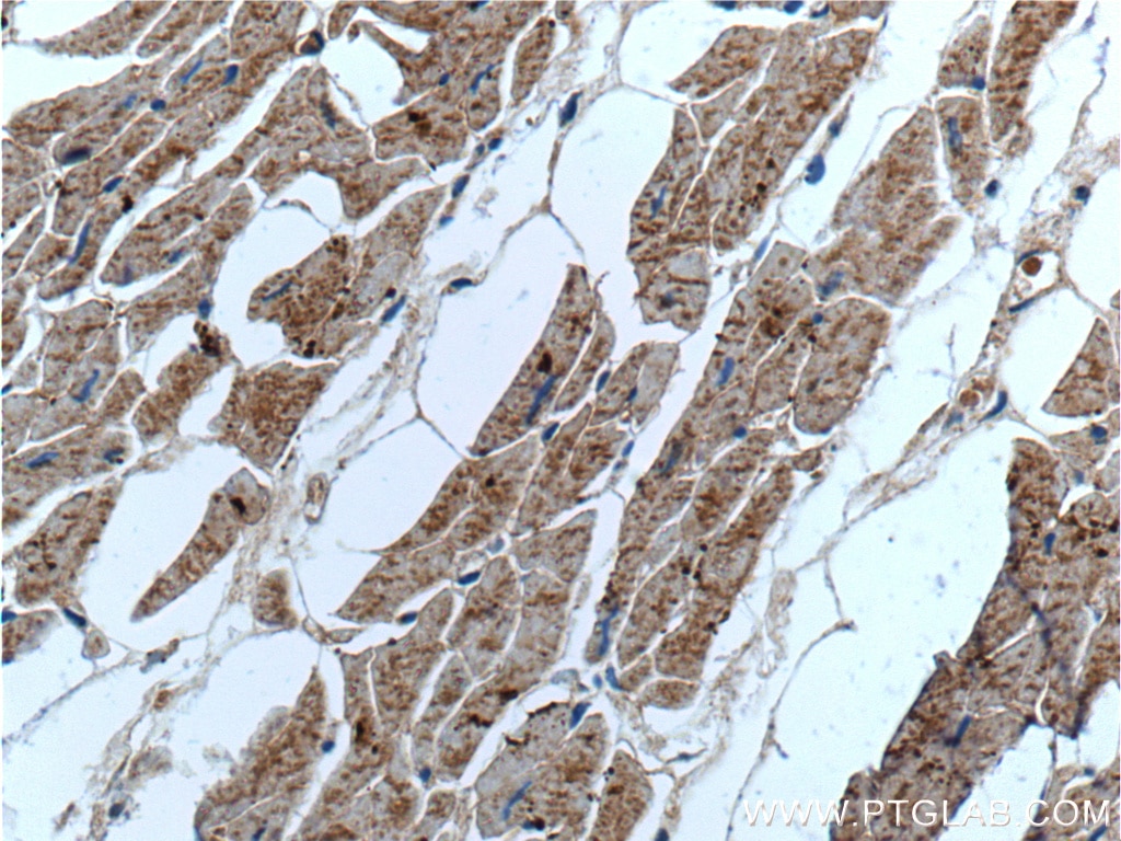 IHC staining of human heart using 19776-1-AP