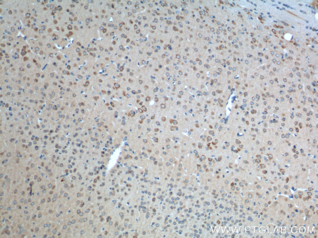 Immunohistochemistry (IHC) staining of mouse brain tissue using ADRA2A Polyclonal antibody (14266-1-AP)