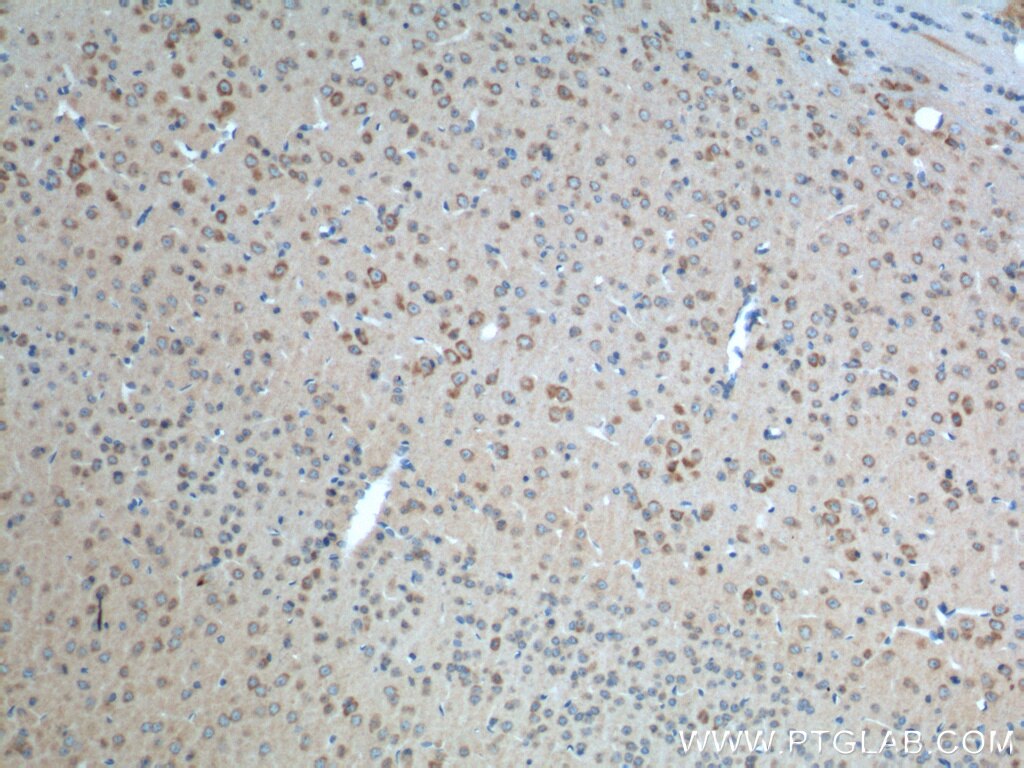 Immunohistochemistry (IHC) staining of mouse brain tissue using ADRA2A Polyclonal antibody (14266-1-AP)