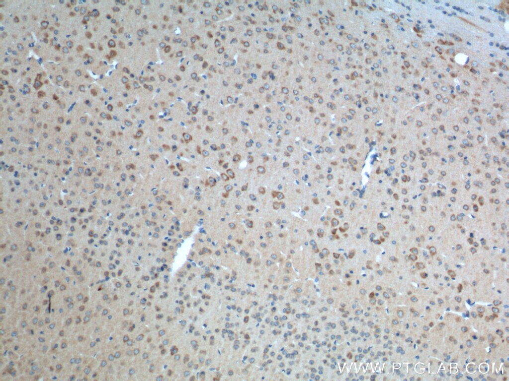 IHC staining of mouse brain using 14266-1-AP