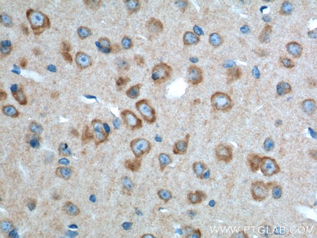 Immunohistochemistry (IHC) staining of mouse brain tissue using ADRA2A Polyclonal antibody (14266-1-AP)