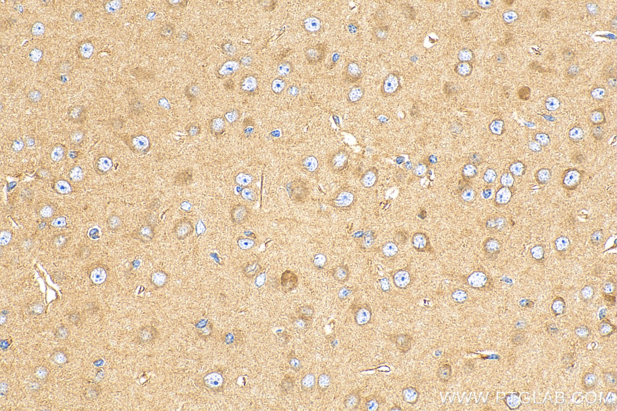 Immunohistochemistry (IHC) staining of mouse brain tissue using ADRA2A Polyclonal antibody (14266-1-AP)