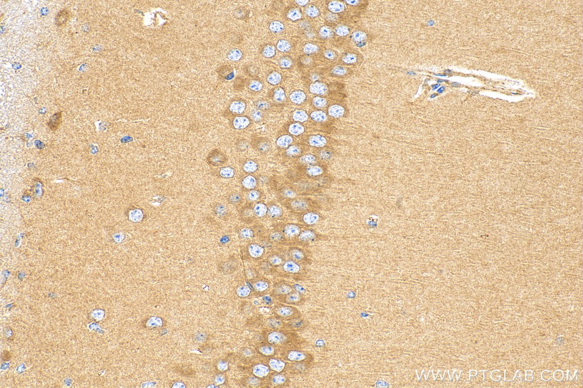 Immunohistochemistry (IHC) staining of mouse brain tissue using ADRA2A Polyclonal antibody (14266-1-AP)