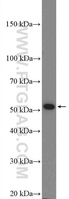 Western Blot (WB) analysis of PC-12 cells using ADRA2A Polyclonal antibody (14266-1-AP)