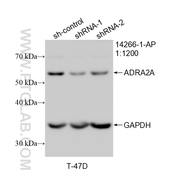 WB analysis of T-47D using 14266-1-AP Western Blot (WB) analysis of T-47D cells using ADRA2A Polyclonal antibody (14266-1-AP)