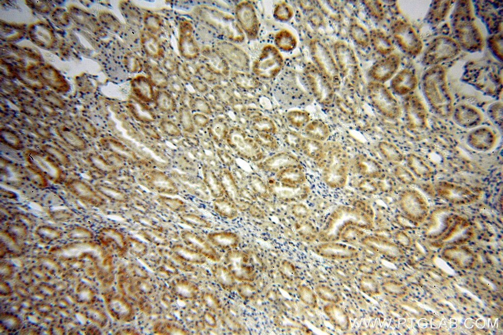 ADRA2B-Specific