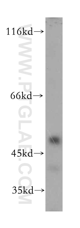 ADRA2B-Specific Polyclonal antibody