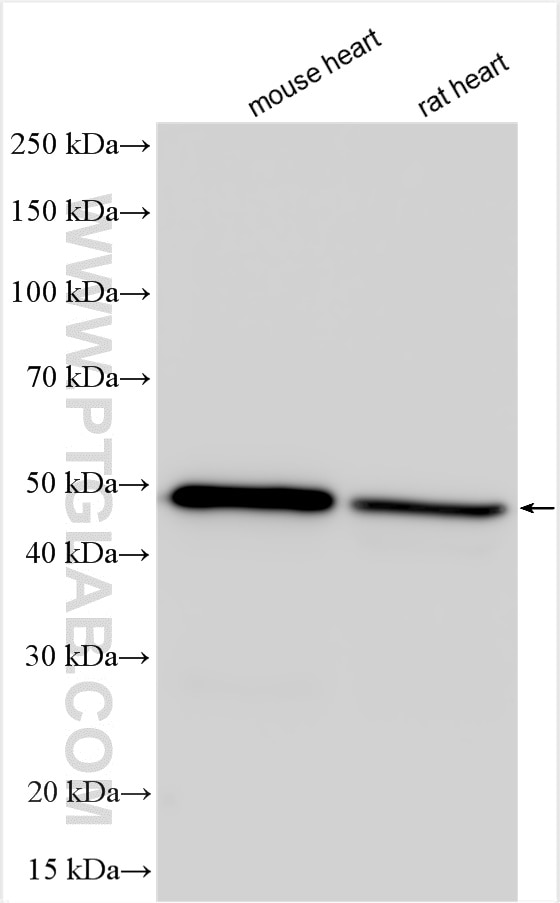 Western Blot (WB) analysis of various lysates using ADRB1 Polyclonal antibody (28323-1-AP)