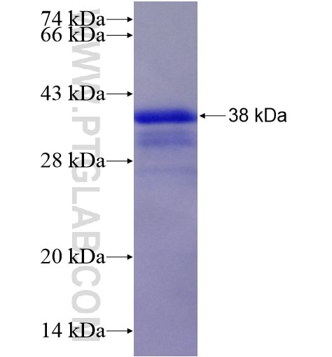 ADRB1 fusion protein Ag28223 SDS-PAGE