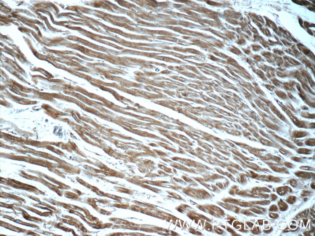 Immunohistochemistry (IHC) staining of human heart tissue using ADRB2 Polyclonal antibody (13096-1-AP)