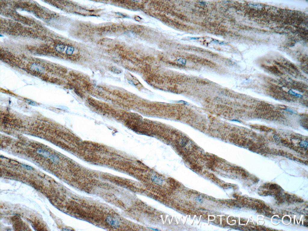 Immunohistochemistry (IHC) staining of human heart tissue using ADRB2 Polyclonal antibody (13096-1-AP)