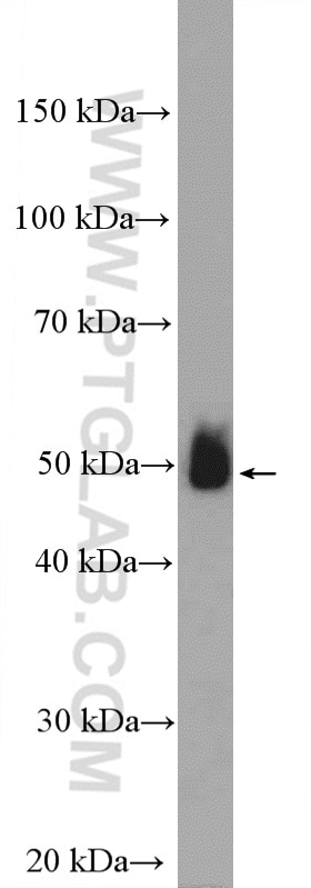 Western Blot (WB) analysis of rat heart tissue using ADRB2 Polyclonal antibody (13096-1-AP)